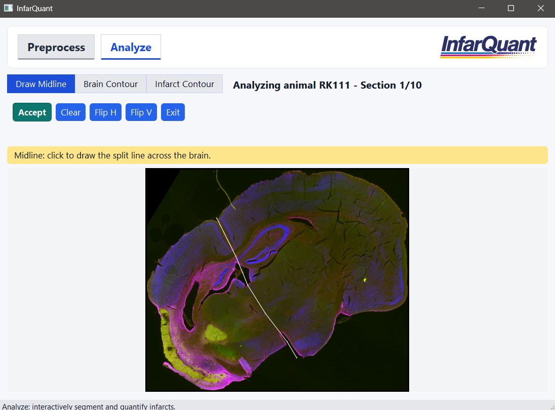 InfarQuant midline drawing interface