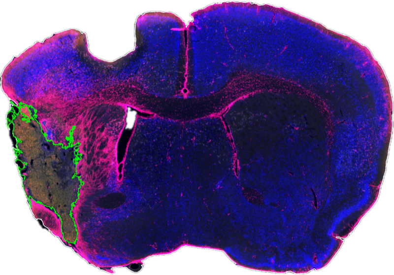Heatmap output from InfarQuant analysis