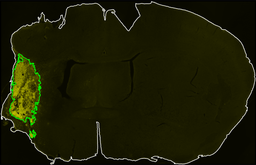 Final infarct segmentation output in InfarQuant