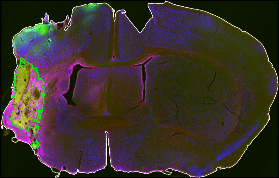 Final merged review output in InfarQuant