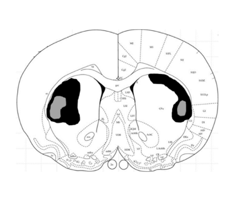 Diagram illustrating striatal lesion study design